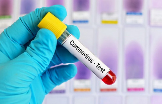 Komiteti për Sëmundje ngjitëse në Kosovë ka përgatitur planin e reagimit për koronavirus