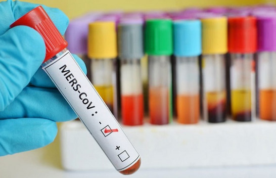IKSHPK konfirmon se nuk ka të sëmurë me koronavirus në Kosovë