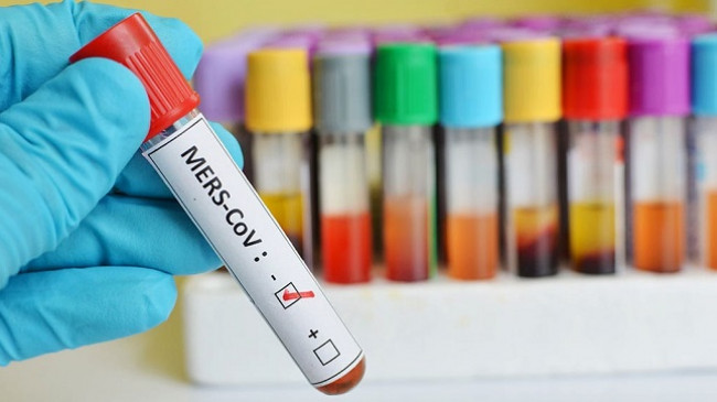 IKSHPK konfirmon se nuk ka të sëmurë me koronavirus në Kosovë