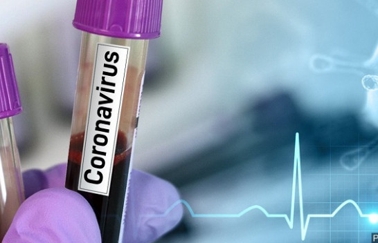 IKSHPK: Rezultatet laboratorike konfirmojnë se në Kosovë s’ka koronavirus