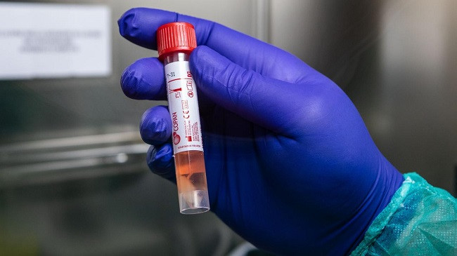 Testohen edhe dy pacientë, në Kosovë nuk s’ka koronavirus