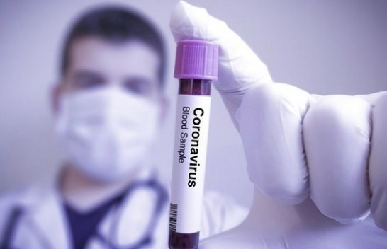 IKSHPK: S’ka koronavirus në Kosovë
