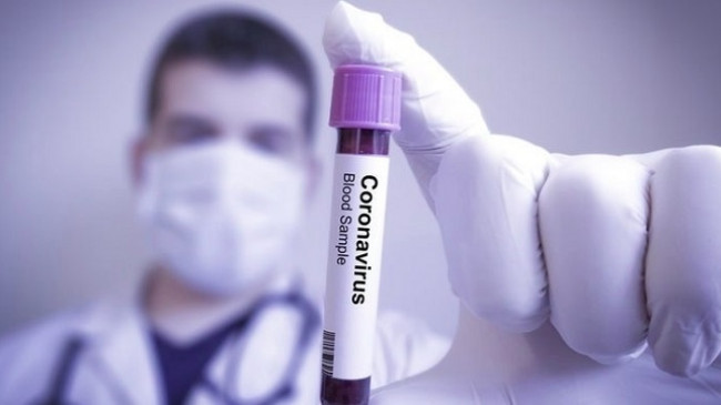 IKSHPK: S’ka koronavirus në Kosovë