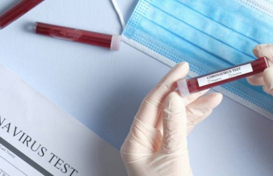 Një kosovar në Gjermani infektohet me koronavirus