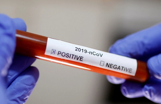 Shkon në 13 numri i të prekurve me koronavirus në Kosovë