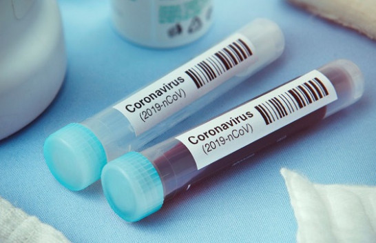 Konfirmohen edhe dy raste të reja me koronavirus në Kosovë