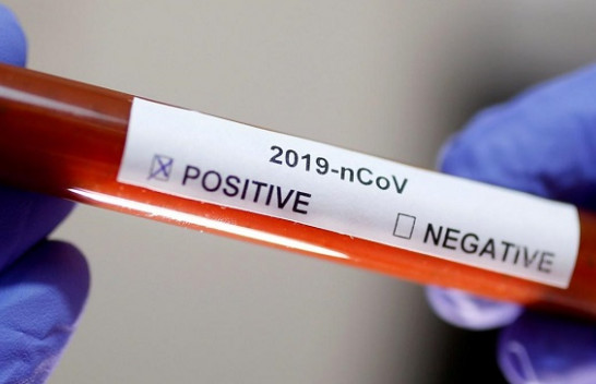 Shkon në 20 numri i të prekurve me koronavirus në Kosovë