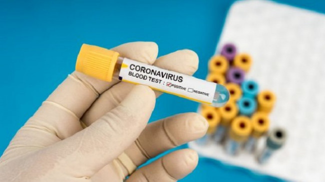 Shënohet edhe një rast me koronavirus në Kosovë, arrin në 21 numri i të prekurve