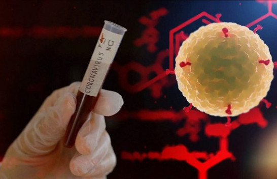 13 raste të reja me koronavirus, shkon në 89 numri i të prekurve në Shqipëri