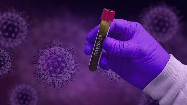 Një foshnje pesë muajshe është prekur me koronavirus në Kamenicë!