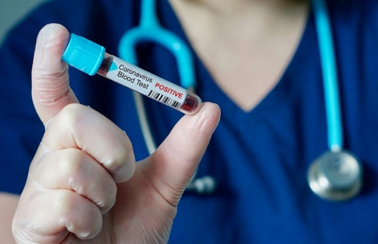 Shkon në 145 numri i të infektuarve me koronavirus në Kosovë
