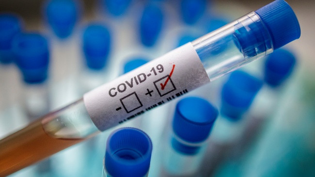 Edhe 20 raste të reja me COVID-19, arrin në 165 numri i të infektuarve në Kosovë