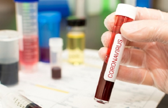 Konfirmohen edhe 27 raste të reja me koronavirus në Kosovë, shkon numri në 277 persona të infektuar