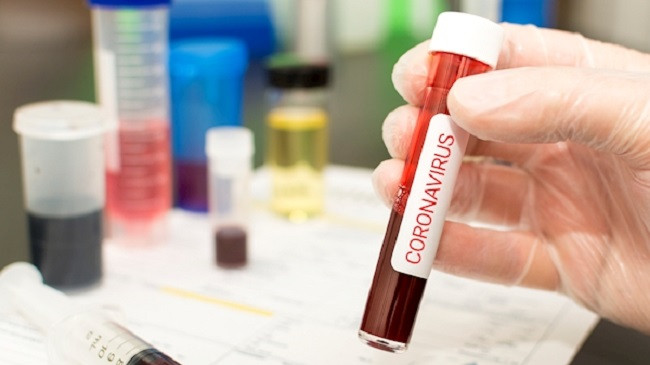 Konfirmohen edhe 27 raste të reja me koronavirus në Kosovë, shkon numri në 277 persona të infektuar