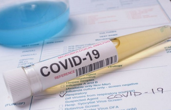 Pesë të shëruar dhe 36 raste të reja me koronavirus – shkon në 423 numri i të prekurve në Kosovë