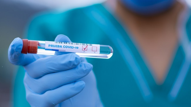 Edhe 11 raste të reja me koronavirus dhe dy të shëruar në Kosovë