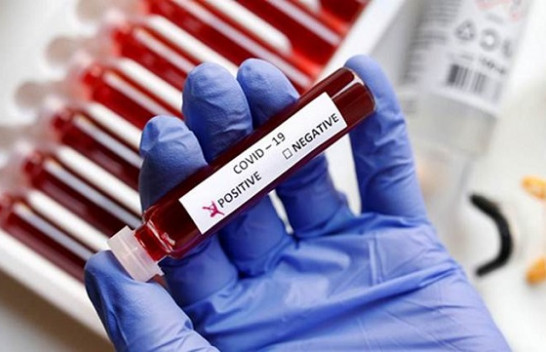 Shtatë raste të reja me koronavirus dhe tre të shëruar në Kosovë