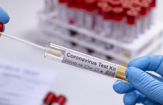 Shtatë të shëruar dhe një rast i ri me koronavirus në Kosovë