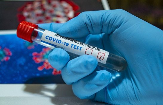 Nëntë të shëruar dhe 12 raste të reja me koronavirus në Kosovë