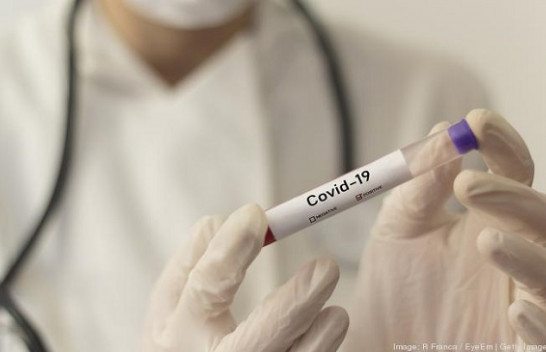 Maqedoni e Veriut, 52 raste të reja me koronavirus – arrin në 2129 numri i të infektuarve