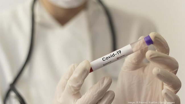 Maqedoni e Veriut, 52 raste të reja me koronavirus – arrin në 2129 numri i të infektuarve