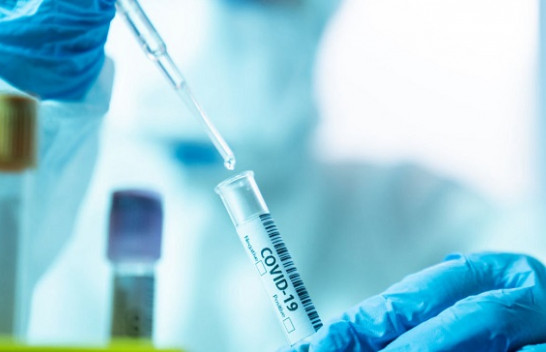 Rritet numri i të infektuarve me koronavirus në Kosovë, 40 raste të reja dhe gjashtë të shëruar