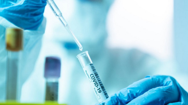 Rritet numri i të infektuarve me koronavirus në Kosovë, 40 raste të reja dhe gjashtë të shëruar