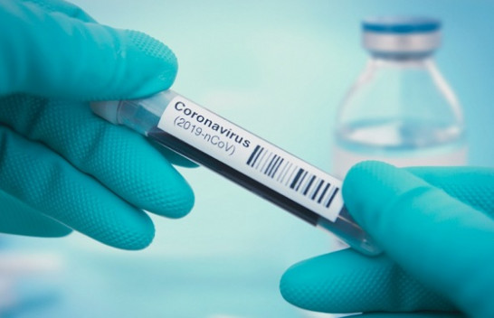 Edhe 28 raste të reja me koronavirus dhe tetë të shëruar në Kosovë