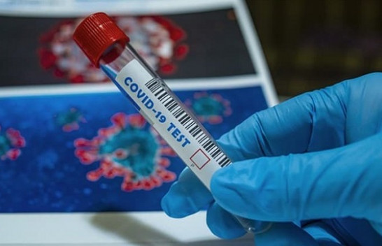 53 raste të reja me koronavirus me COVID-19 dhe shtatë të shëruar në Kosovë