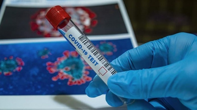 53 raste të reja me koronavirus me COVID-19 dhe shtatë të shëruar në Kosovë
