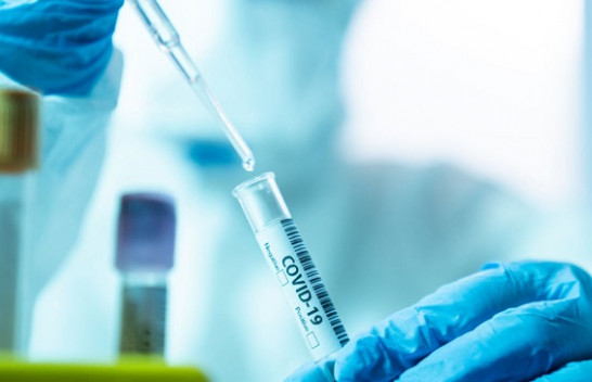 Rekord të infektuarish/ 129 raste të reja me koronavirus dhe 10 të shëruar në Kosovë