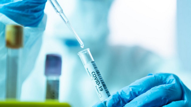 Rekord të infektuarish/ 129 raste të reja me koronavirus dhe 10 të shëruar në Kosovë