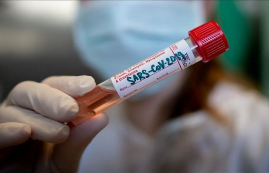 77 raste të reja me koronavirus në Kosovë