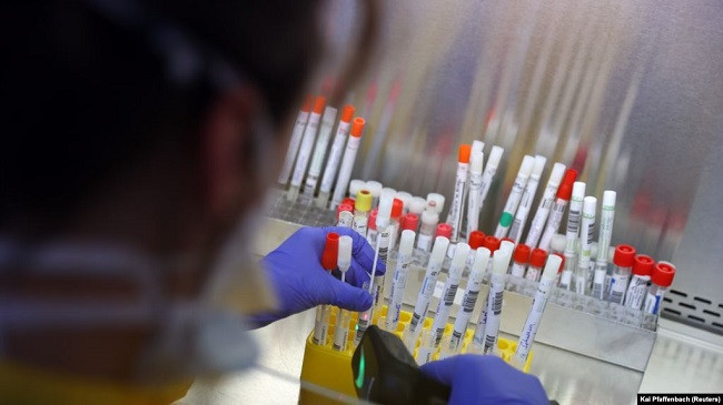 182 raste të reja me koronavirus dhe 33 të shëruar në Maqedoni