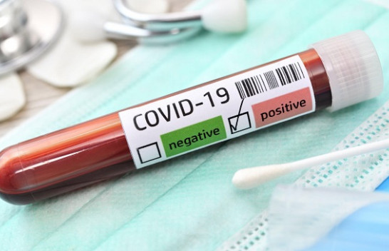 82 raste të reja me koronavirus dhe shtatë të shëruar në Kosovë