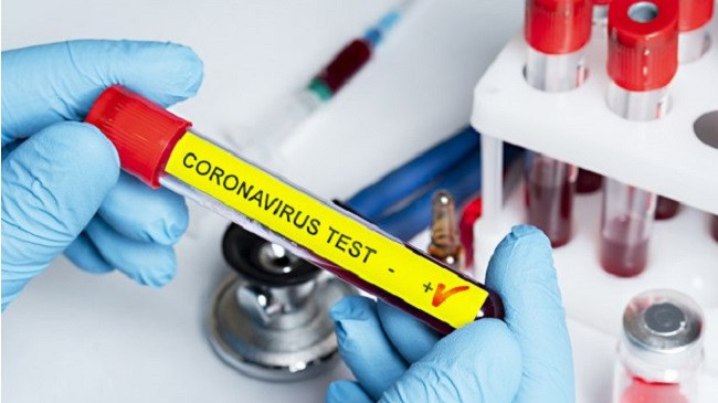 Konfirmohen edhe 96 raste të reja me koronavirus dhe 29 të shëruar në Kosovë