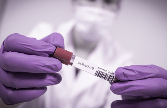 61 të shëruar dhe 62 raste të reja me koronavirus në Kosovë