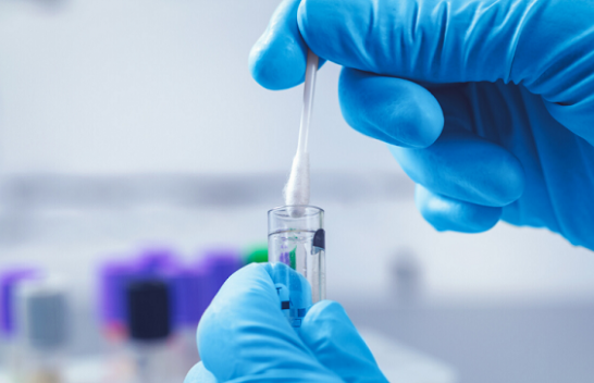 Sot 113 raste të reja me koronavirus dhe 67 të shëruar në Kosovë