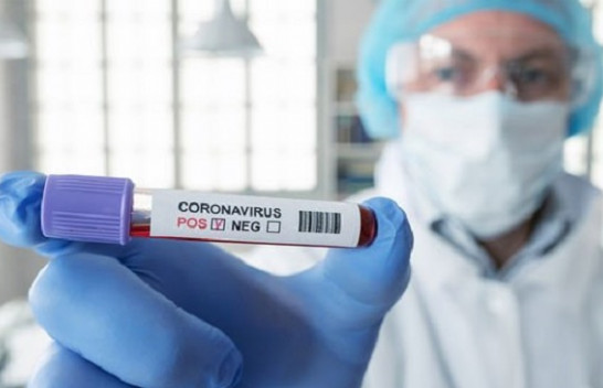 73 raste të reja me koronavirus në Kosovë