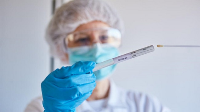 Vazhdon të rritet numri i të infektuarve me koronavirus në Kosovë, vetëm sot 152 raste të reja