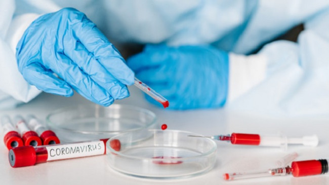 Alarmante, 276 raste të reja me koronavirus dhe 153 të shëruar në Kosovë