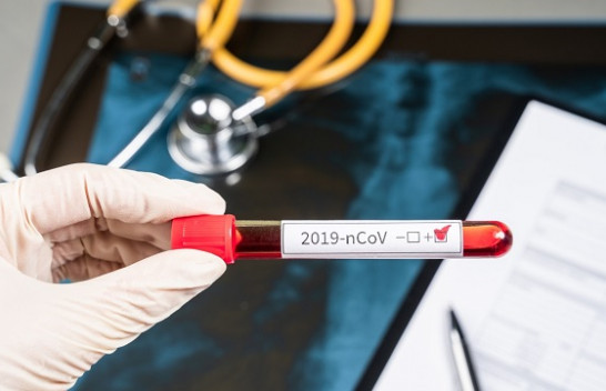 Konfirmohen 226 raste të reja me koronavirus dhe 115 të shëruar në Kosovë