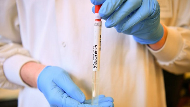 IKSHPK konfirmon 224 raste të reja me koronavirus dhe 152 të shëruar