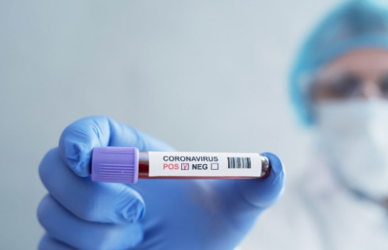 Konfirmohen 245 raste të reja me koronavirus dhe 133 të shëruar në Kosovë