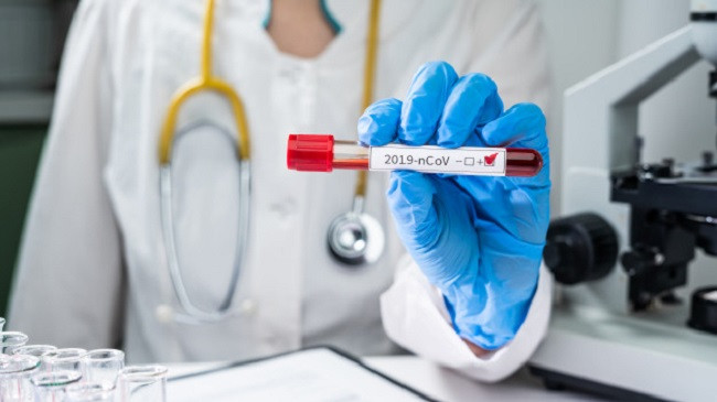 225 raste të reja me koronavirus dhe 201 të shëruar në Kosovë