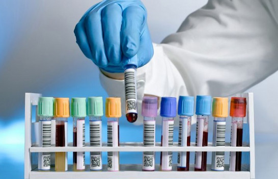 Ministria e Shëndetësisë publikon listën e laboratorëve privatë që do të kryejnë teste serologjike dhe molekulare për COVID-19