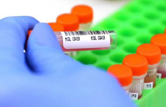 Rënie e lehtë e të infektuarve me koronavirus në Kosovë: 99 raste të reja dhe 152 të shëruar