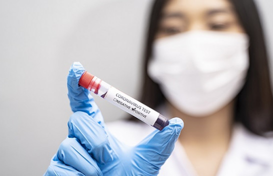 Të dhënat për 24 orët e fundit nga IKSHPK: 57 raste të reja dhe 137 të shëruar nga koronavirus në Kosovë