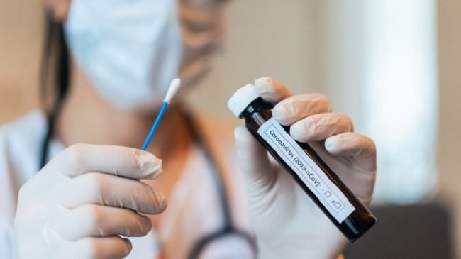 Rënie e lehtë e numrit të infektuarve me koronavirus në Kosovë