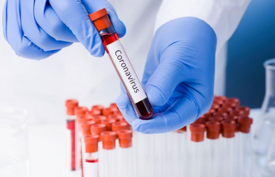 Rritet numri i të infektuarve me koronavirus në Kosovë